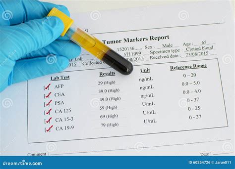 Understanding Tumor Marker Results: What Do the。